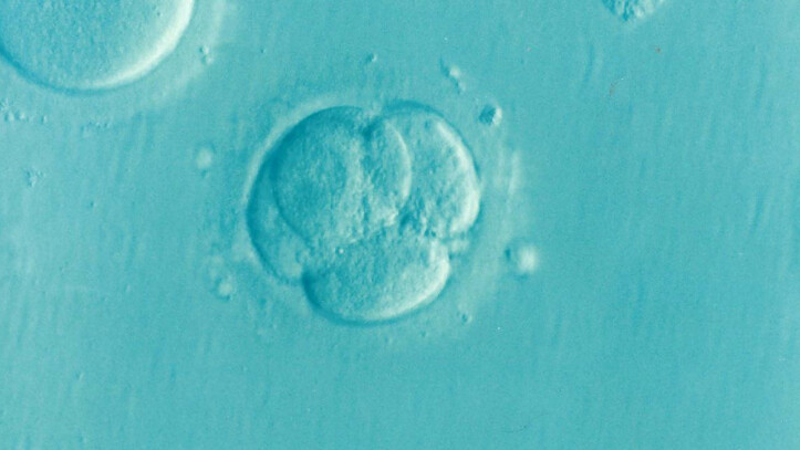 corte suprema alabama embrione congelato